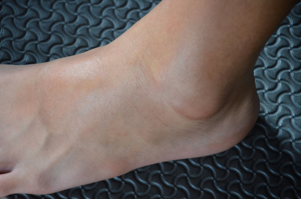 What Are Cankles And Tips On How To Get Rid Of Them